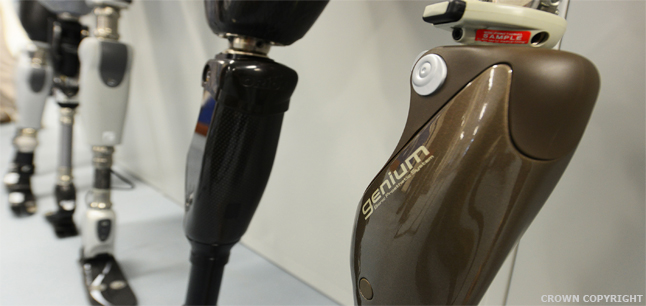 Image of prosthetic legs